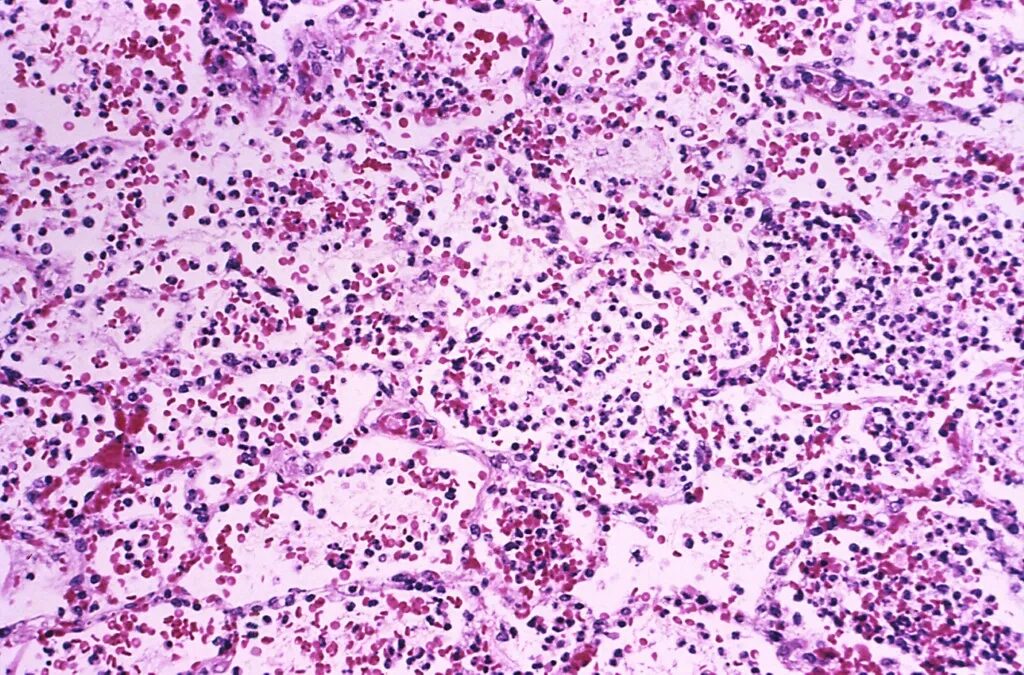 Rússia nega 2º contágio em caso suspeito de peste após morte de laboratorista